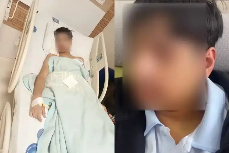 Antalya'da Akran Zorbalığı: Genç İki Arkadaşın Tartışmasında Çene Kırıldı