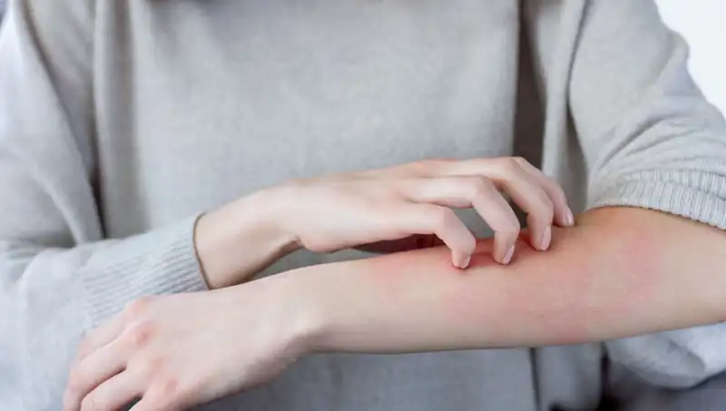 Cilt Kanserinin Gizli Belirtileri: Dermatologdan İlginç Uyarılar