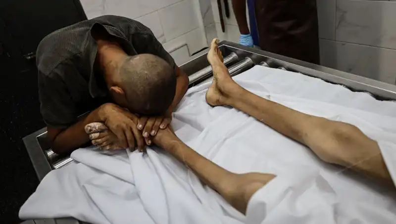 Gazze'de Çocuk Açlığının Korkunç Boyutu: Bir Can Daha Kaybedildi